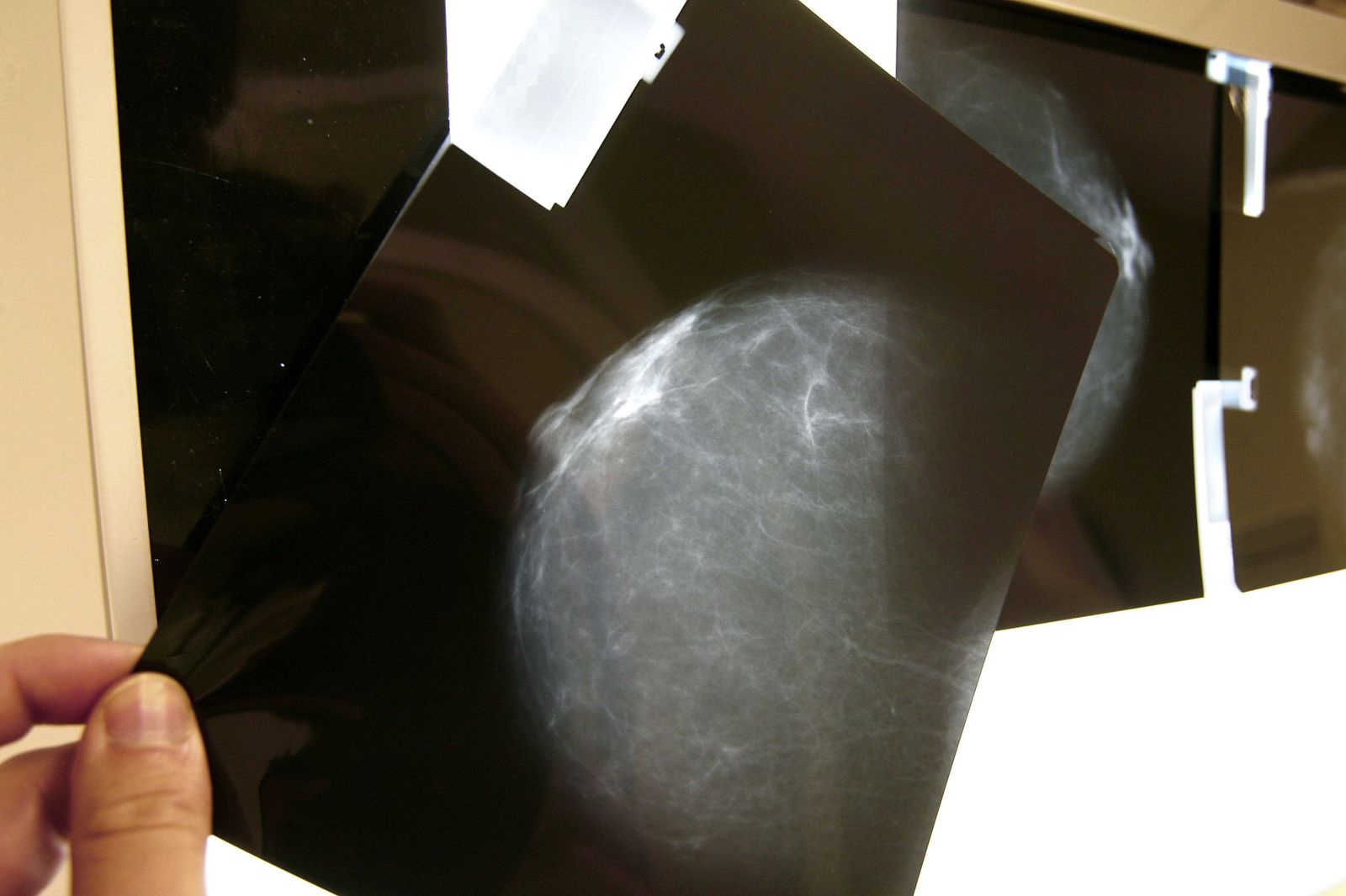 Un "caballo de Troya" farmacológico se reafirma como terapia contra el cáncer